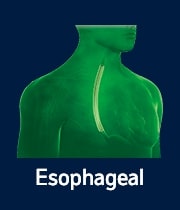Esophageal - Biomarker Image Bank