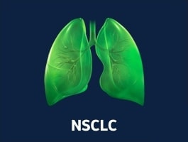 NSCLC - Biomarker Image Bank