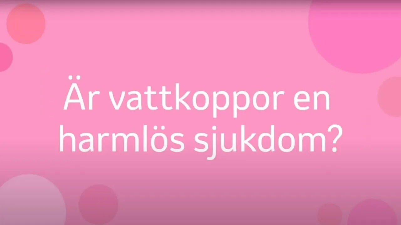 Är vattkoppor en harmlös sjukdom?