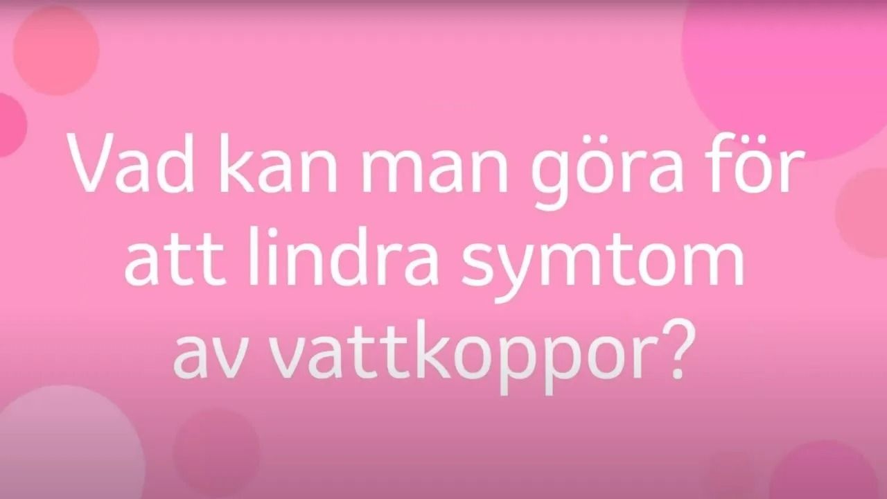 Vad kan man göra för att linda symtom av vattkoppor?